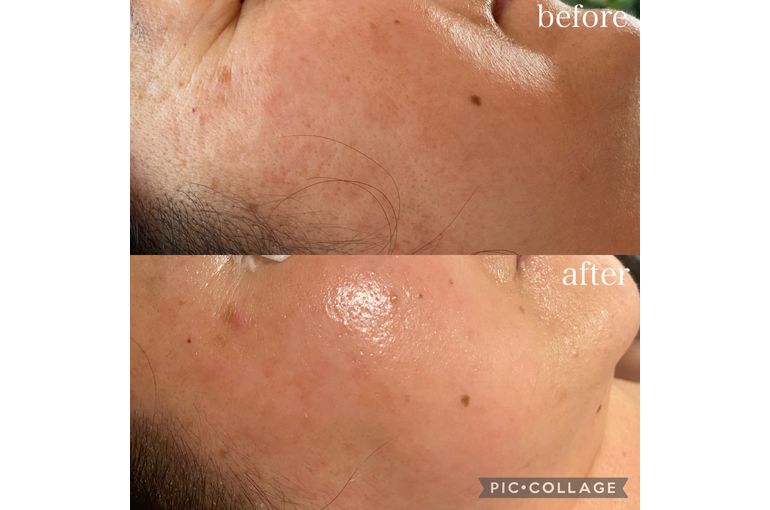 リアボーテ 大阪】ハーブトリートメントの効果 フェイシャル専門店