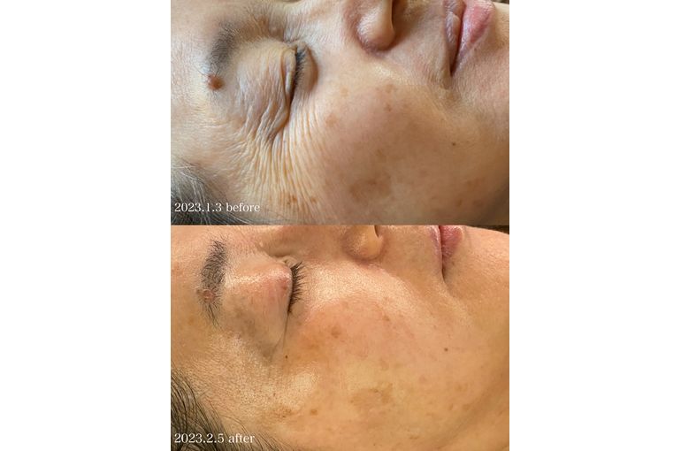 クレアスキンの洗顔