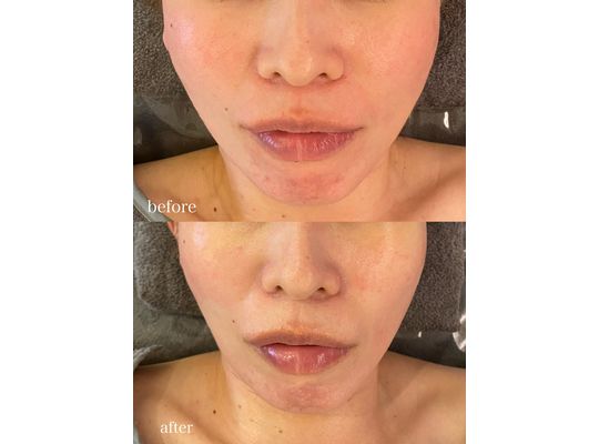 シェリースキンの化粧水