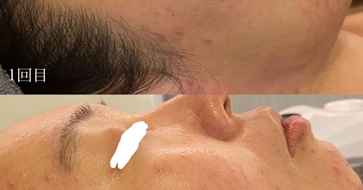 新品未使用★シェリースキン　クレンジングと洗顔