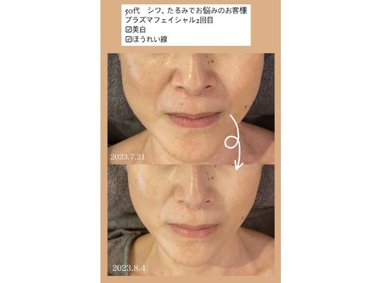 リアボーテ　クレアスキン