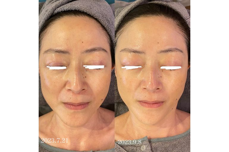 リアボーテ　クレアスキン