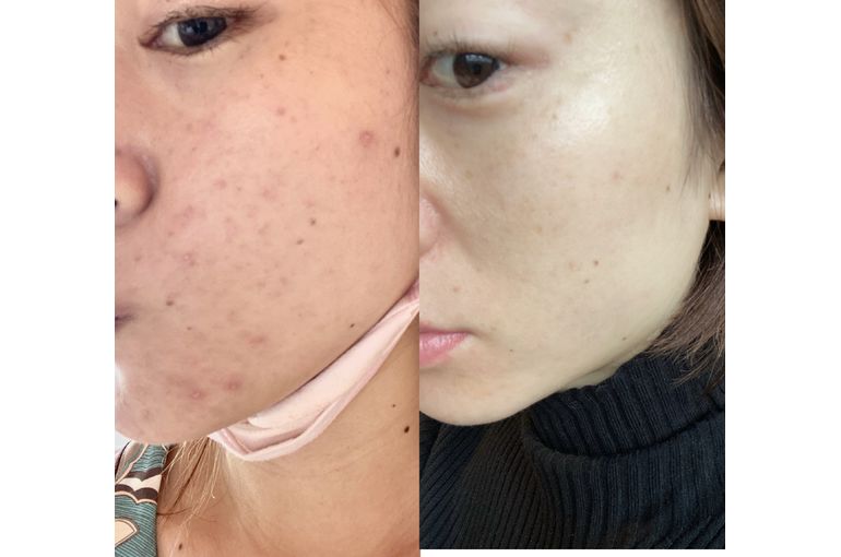 リアボーテ　ハーブトリートメント