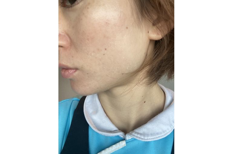 リアボーテ　ハーブトリートメント