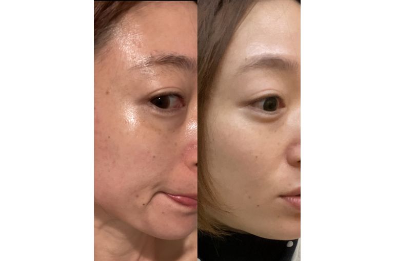 リアボーテ　クレアスキン