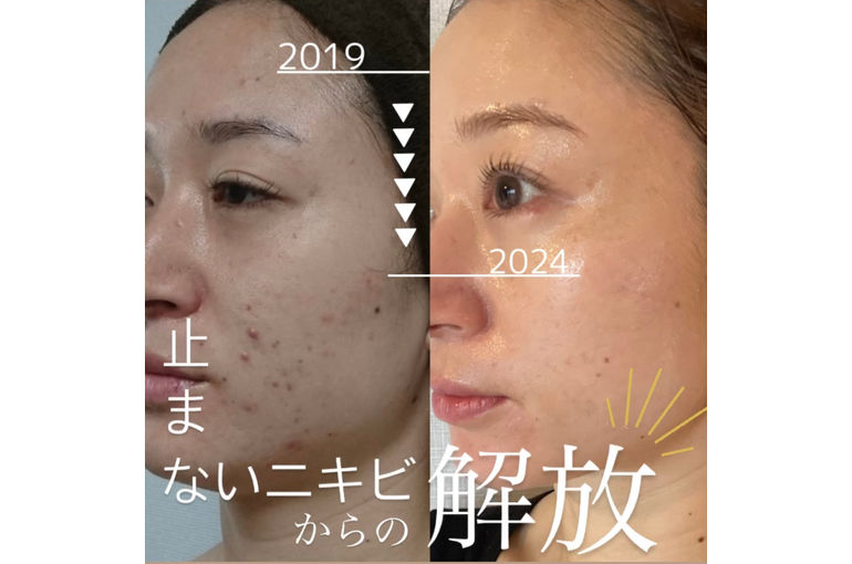 リアムール　エキスパートローション