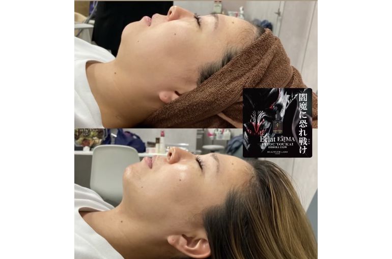 リアボーテ　ディゾセラム