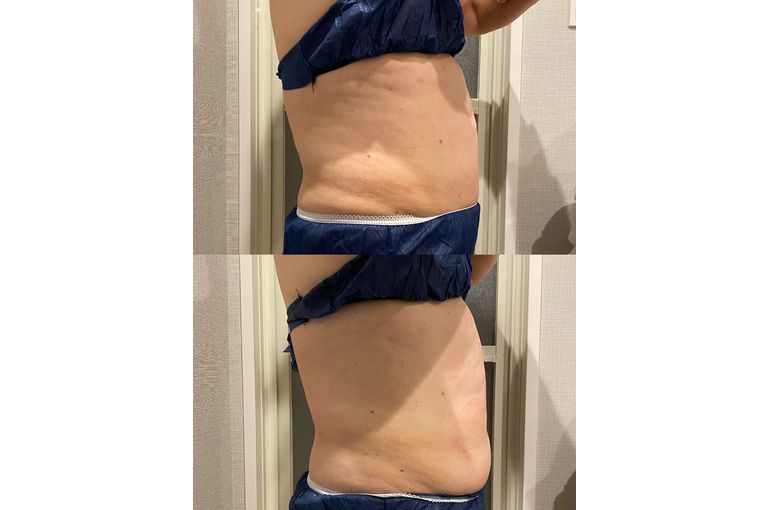 リアボーテ　ディゾセラム