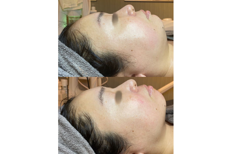 リアボーテ　ディゾセラム