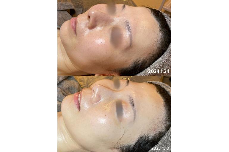 リアボーテ　シェリースキン