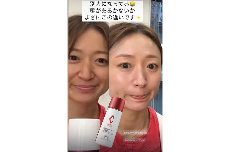 リアボーテ　シェリースキン