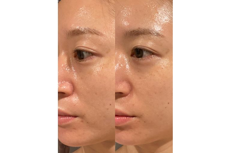 リアボーテ　クレアスキン