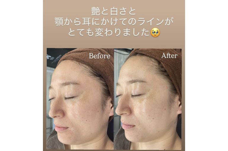 リアボーテ　KIWAMI