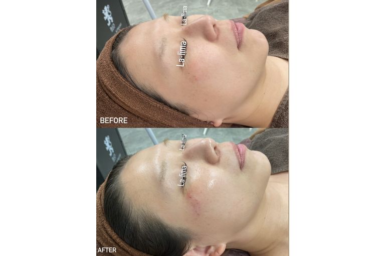 リアボーテ　クレアスキン