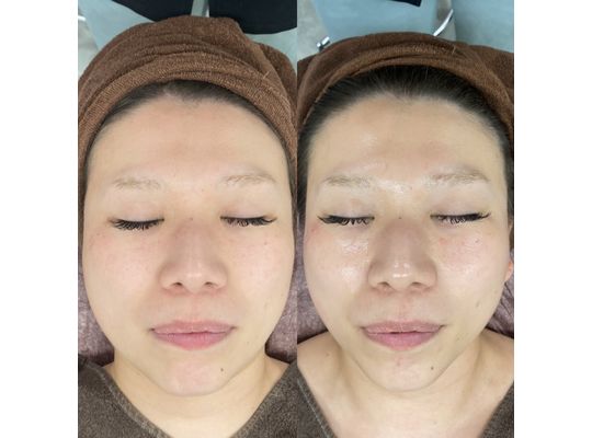 ボーテデラボ　kiwami