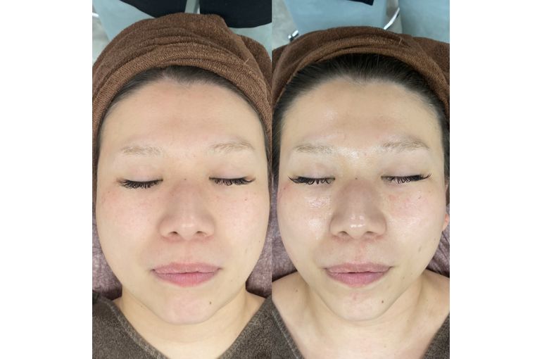 ボーテデラボ　kiwami