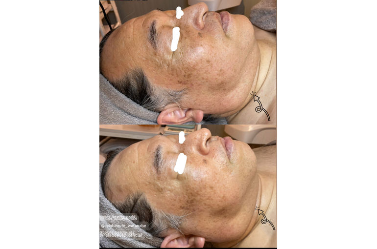 ボーテデラボ kiwami