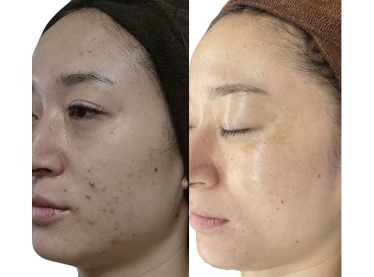 最新の美容情 | 大阪市のエステサロン・La-limaはスタッフブログ