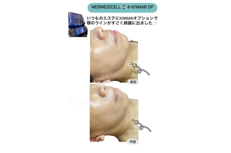 ボーテデラボ kiwami