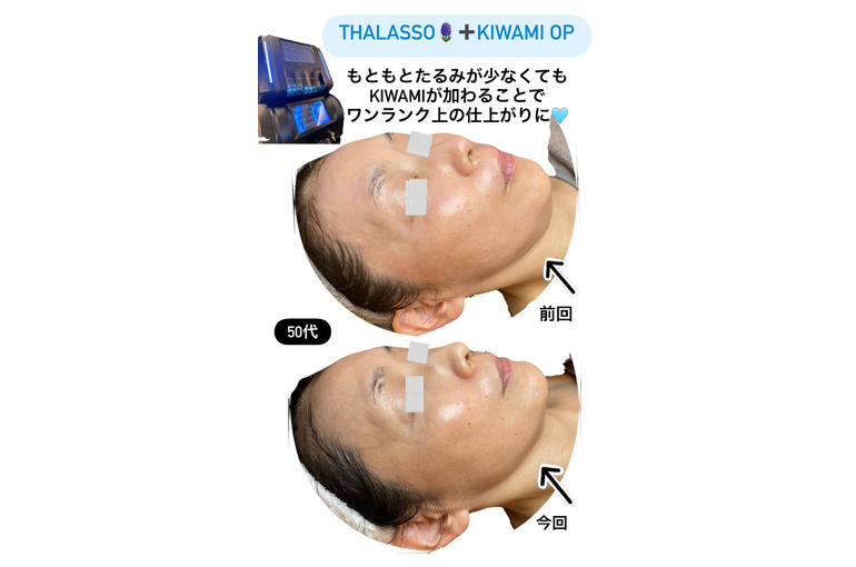 ボーテデラボ　 kiwami