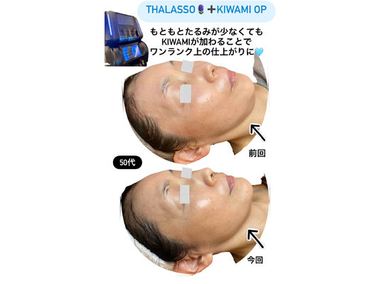 ボーテデラボ　kiwami