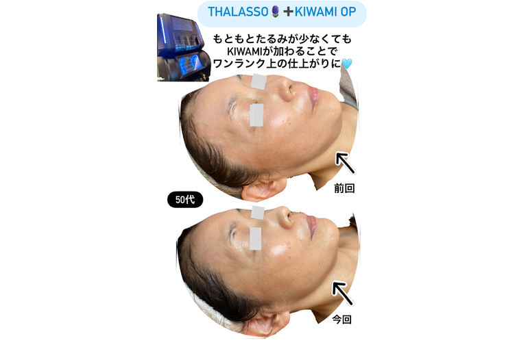 リアボーテ　化粧品