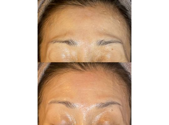 リアボーテ　クレアスキン