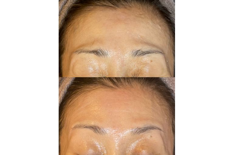 リアボーテ　クレアスキン