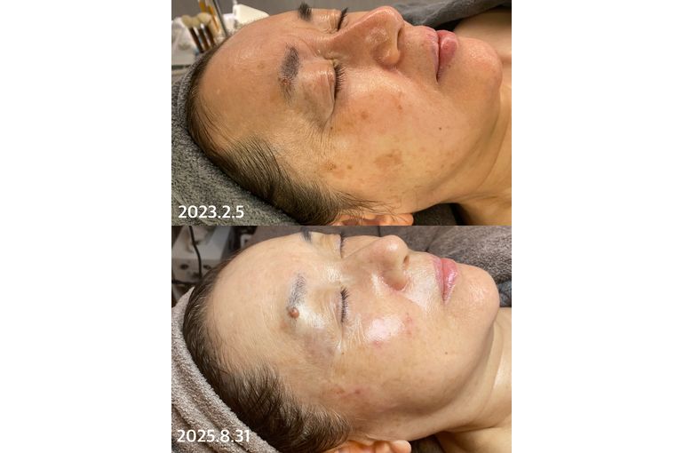 リアボーテ　クレアスキン