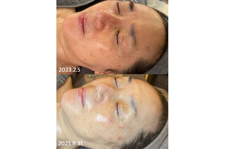 リアボーテ　クレアスキン