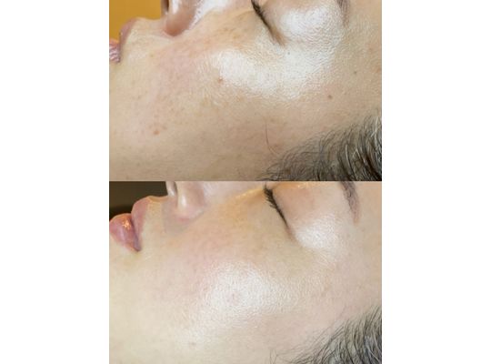 ボーテデラボ　kiwami