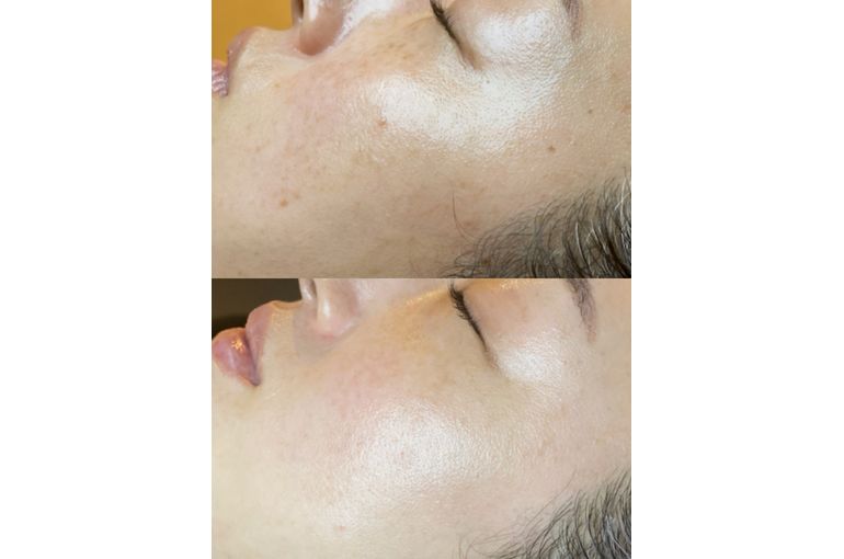 リアボーテ　化粧品