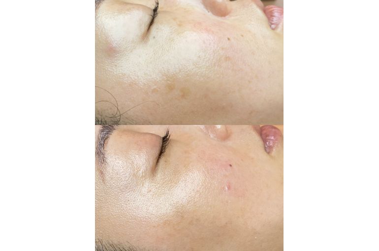 リアボーテ　化粧品