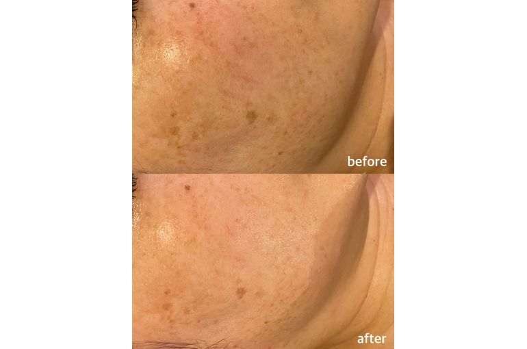 リアボーテ　クレアスキン