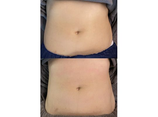 マックスボディ　効果