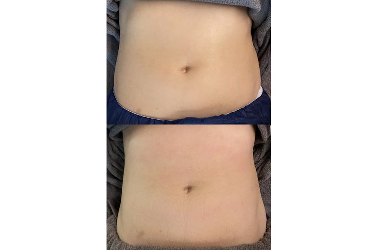 マックスボディ　効果