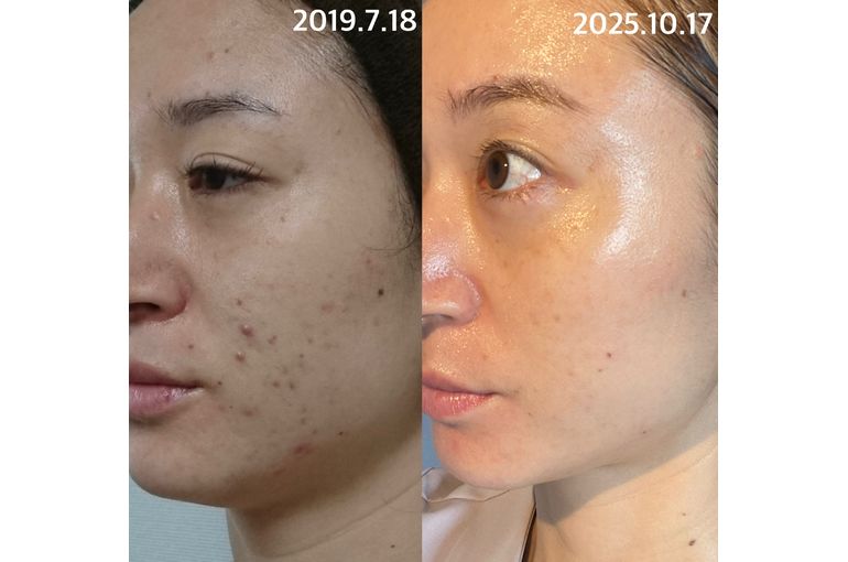 リアボーテ　化粧品