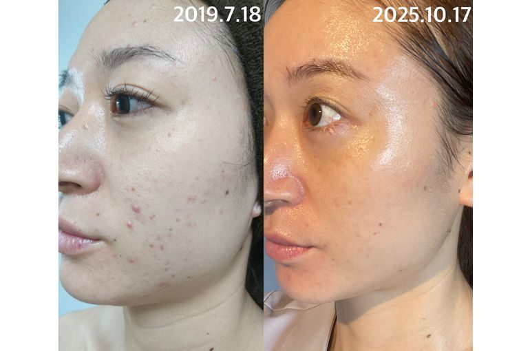 リアボーテ　クレアスキン