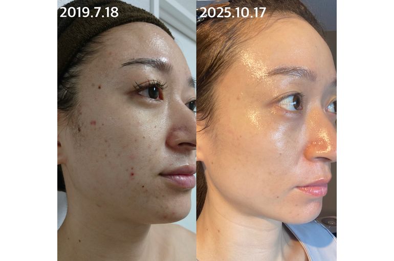 リアボーテ　化粧品