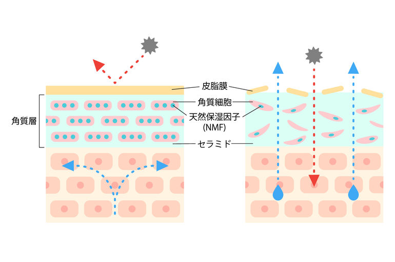 リアボーテ　シェリースキン