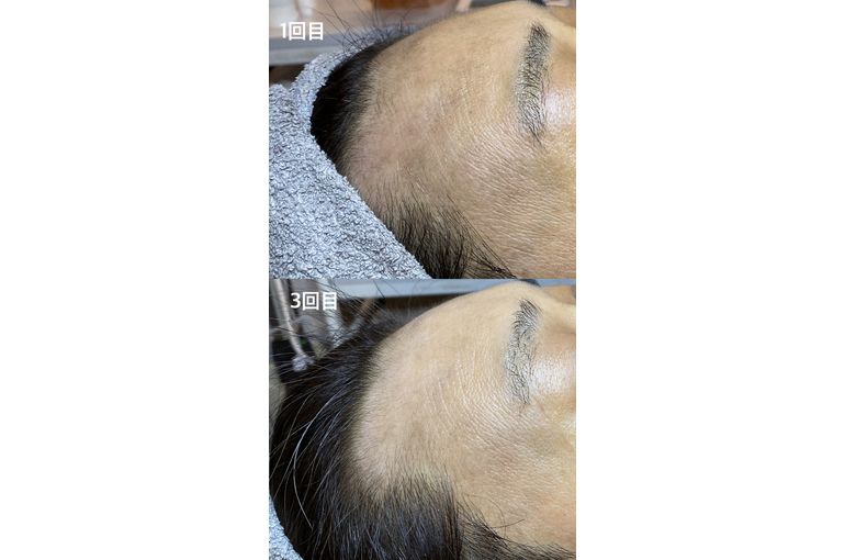 リアボーテ　KIWAMI