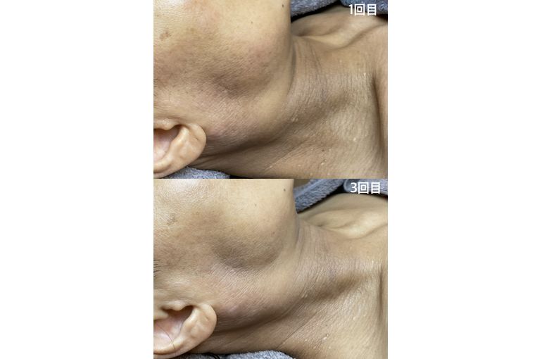 リアボーテ　KIWAMI