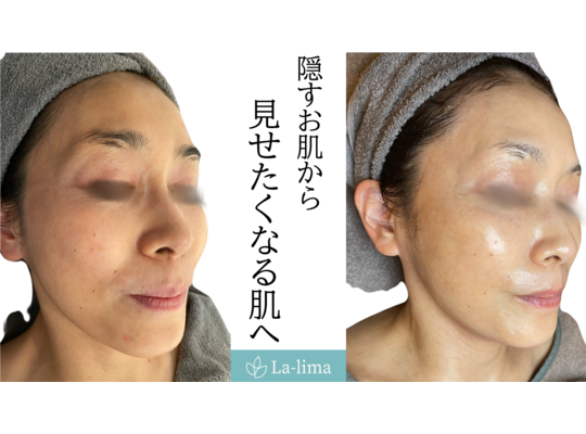 リアボーテ　化粧品