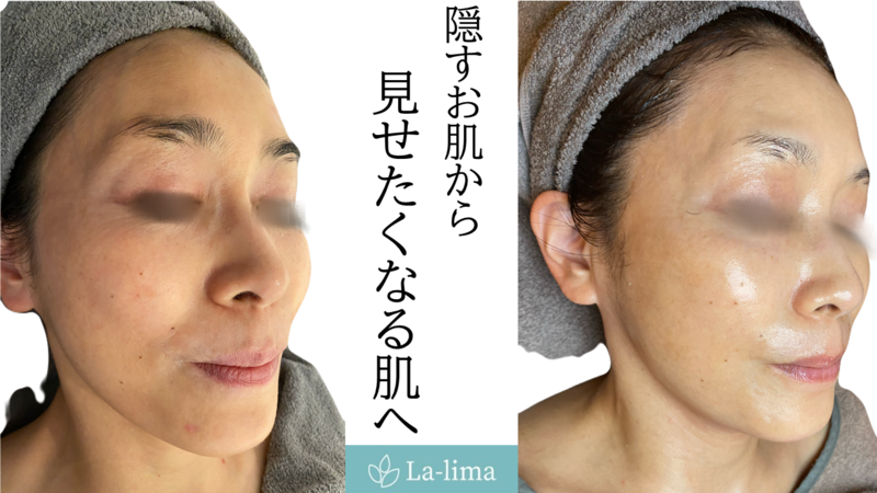 facial16.png