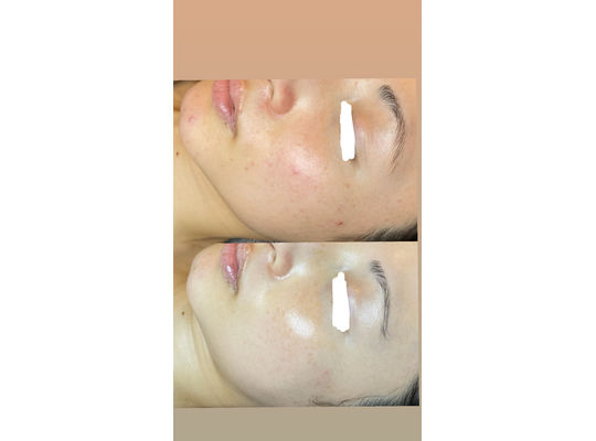 リアボーテ　シェリースキン