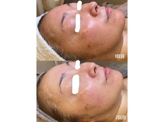 リアボーテ　化粧品