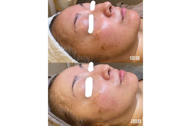 リアボーテ　化粧品