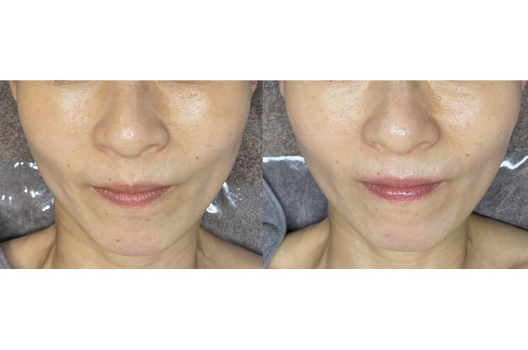 リアボーテ　化粧品